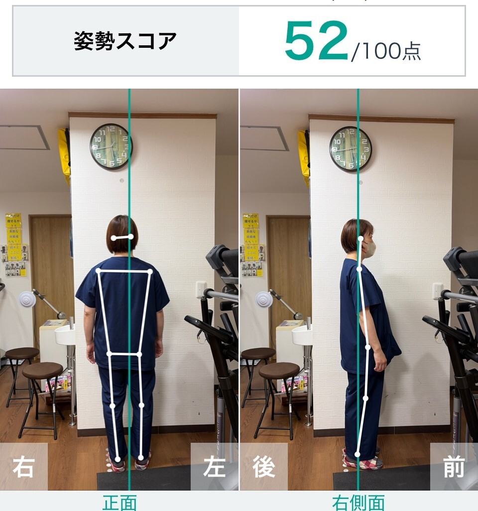 AI診断 分離上